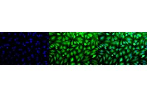 Immunocytochemistry/Immunofluorescence analysis using Rabbit Anti-Erk1/2 Polyclonal Antibody (ABIN361832 and ABIN361833). (ERK1 antibody)