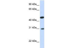 WB Suggested Anti-LOC388323 Antibody Titration:  0. (GLTPD2 antibody  (N-Term))