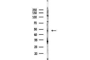 anti-GATA Binding Protein 4 (GATA4) (pSer262) antibody