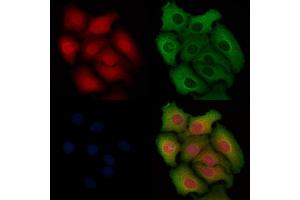 ABIN6254880 and ABIN6268792 staining Hela cells by IF/ICC. (Caspase 9 antibody  (Cleaved-Asp330))