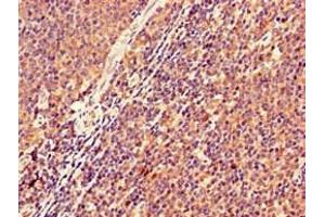 Immunohistochemistry of paraffin-embedded human lymph node tissue using ABIN7157511 at dilution of 1:100 (KIR2DS2 antibody  (AA 104-241))