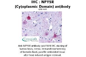 Image no. 1 for anti-Neuropeptide Y Receptor Y5 (NPY5R) (1st Cytoplasmic Domain) antibody (ABIN1737487) (NPY5R antibody  (1st Cytoplasmic Domain))