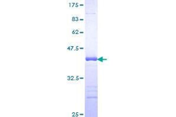 FAF1 Protein (AA 551-650) (GST tag)