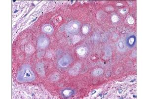 Immunohistochemistry of Rabbit Anti-Collagen II Biotin Conjugated Antibody. (COL2A1 antibody  (FITC))