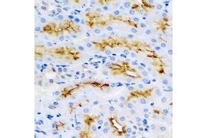 Immunohistochemical analysis of BMP15 staining in rat kidney formalin fixed paraffin embedded tissue section. (BMP15 antibody)