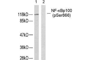 Western blot analysis of extracts from ovary cancer cells using NF-κ,B p100 (phospho-Ser866) antibody. (NFKB2 antibody  (pSer866))