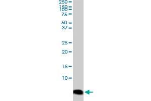 ATOX1 monoclonal antibody (M04), clone 3G11. (ATOX1 antibody  (AA 1-68))