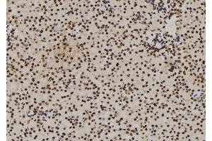 ABIN6272913 at 1/100 staining Mouse kidney tissue by IHC-P. (DDX21 antibody  (Internal Region))