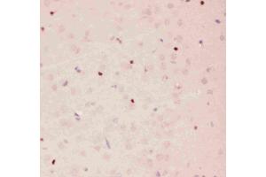 Immunohistochemistry (IHC) image for anti-Apurinic/Apyrimidinic Endonuclease 1 (APEX1) (AA 2-318) antibody (ABIN3043785)