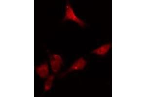 ABIN6274116 staining HeLa cells by IF/ICC. (DKC1 antibody  (Internal Region))