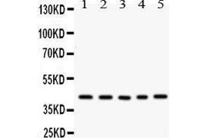 Western Blotting (WB) image for anti-Cysteine-Rich, Angiogenic Inducer, 61 (CYR61) (AA 54-381) antibody (ABIN3042351) (CYR61 antibody  (AA 54-381))