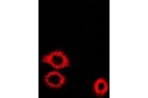 Immunofluorescent analysis of ADE2 staining in U2OS cells. (PAICS antibody)