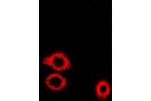 Immunofluorescent analysis of ADE2 staining in U2OS cells.