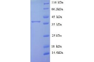 Transmembrane Protein 14B (TMEM14B) (AA 1-114), (full length) protein (GST tag)