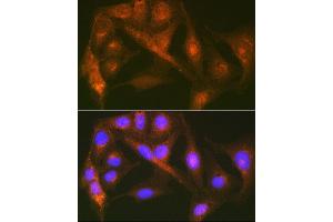 Immunofluorescence analysis of U-2 OS cells using Cortactin Rabbit mAb (ABIN7266511) at dilution of 1:100 (40x lens). (Cortactin antibody)