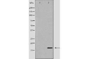 Western blot analysis of human testis lysate using LYZL6 antibody. (LYZL6 antibody  (Internal Region))