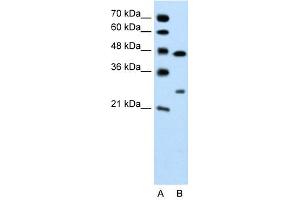 Western Blot showing Claudin 18 antibody used at a concentration of 1-2 ug/ml to detect its target protein. (Claudin 18 antibody  (C-Term))