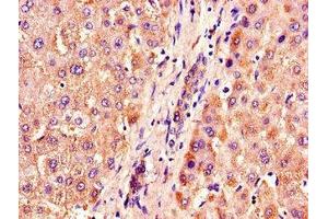 Immunohistochemistry of paraffin-embedded human liver tissue using ABIN7162949 at dilution of 1:100 (ACOX1 antibody  (AA 113-273))
