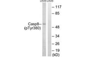 Western blot analysis of extracts from LOVO cells treated with UV 15', using Caspase 8 (Phospho-Tyr380) Antibody.