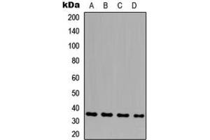 Western blot analysis of GLB1L3 expression in HeLa (A), THP1 (B), NS-1 (C), H9C2 (D) whole cell lysates.