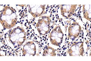 Detection of CASP10 in Human Colon Tissue using Polyclonal Antibody to Caspase 10 (CASP10) (Caspase 10 antibody  (AA 223-459))