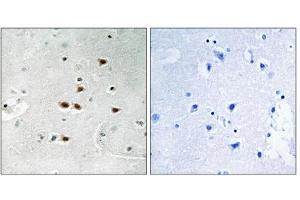 Immunohistochemistry analysis of paraffin-embedded human brain tissue using ITCH (Phospho-Tyr420) antibody. (ITCH antibody  (pTyr420))