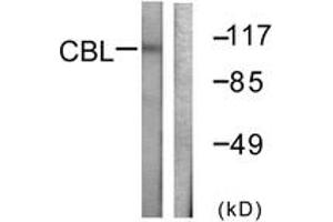 Western blot analysis of extracts from HeLa cells, treated with EGF 200ng/ml 30', using CBL (Ab-774) Antibody. (CBL antibody  (AA 740-789))