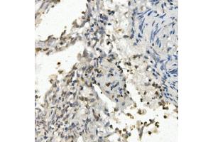 IHC analysis of FOXF1 using anti-FOXF1 antibody (ABIN7601744).