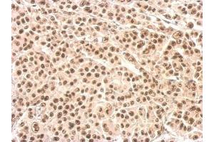 IHC-P Image XRCC4 antibody detects XRCC4 protein at nucleus on HBL435 xenograft by immunohistochemical analysis. (XRCC4 antibody  (C-Term))