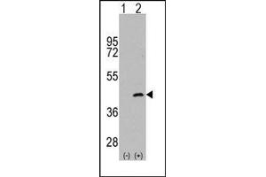 Image no. 1 for anti-Mitogen-Activated Protein Kinase Kinase 4 (MAP2K4) (Ser257) antibody (ABIN360303)