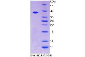SDS-PAGE (SDS) image for Chemokine (C-C Motif) Ligand 4-Like 1 (CCL4L1) (AA 24-92) protein (His tag,GST tag) (ABIN2122613)