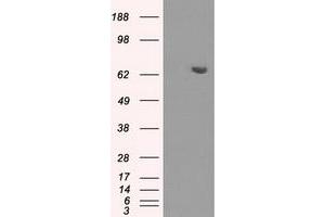 HEK293T cells were transfected with the pCMV6-ENTRY control (Left lane) or pCMV6-ENTRY HDAC10 (Right lane) cDNA for 48 hrs and lysed. (HDAC10 antibody)