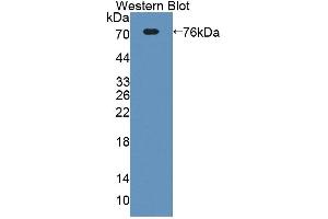 Western blot analysis of the recombinant protein. (ECM1 antibody  (AA 20-434))
