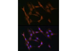Immunofluorescence analysis of C6 cells using TGF beta Receptor II (TGF beta Receptor II (TGFBR2)) Rabbit pAb (ABIN6130734, ABIN6149084, ABIN6149087 and ABIN6215460) at dilution of 1:50 (40x lens). (TGFBR2 antibody  (AA 23-280))