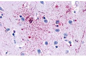 Anti-GPR139 antibody  ABIN1048723 IHC staining of human brain, neurons and glia. (GPR139 antibody  (Transmembrane Domain))