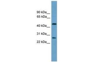 Image no. 1 for anti-Elongator Acetyltransferase Complex Subunit 4 (ELP4) (AA 101-150) antibody (ABIN6744601) (ELP4 antibody  (AA 101-150))