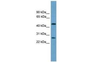 Image no. 1 for anti-Elongator Acetyltransferase Complex Subunit 4 (ELP4) (AA 101-150) antibody (ABIN6744601)