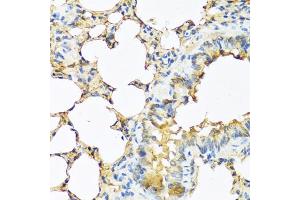 Immunohistochemistry of paraffin-embedded mouse lung using TSHB antibody (ABIN6132751, ABIN6149620, ABIN6149621 and ABIN6222522) at dilution of 1:100 (40x lens). (TSHB antibody  (AA 21-138))