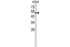 Western blot analysis of PTGIS Antibody (C-term) Cat. (PTGIS antibody  (C-Term))