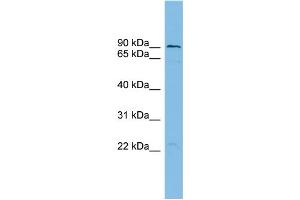 WB Suggested Anti-TBC1D16 Antibody Titration: 0. (TBC1D16 antibody  (N-Term))