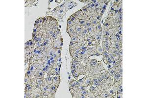 Immunohistochemistry of paraffin-embedded human stomach using Carbonic Anhydrase 9 (C/G250) antibody (ABIN6131266, ABIN6137798, ABIN6137800 and ABIN6217767) at dilution of 1:100 (40x lens). (CA9 antibody  (AA 52-151))