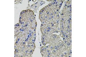 Immunohistochemistry of paraffin-embedded human stomach using Carbonic Anhydrase 9 (C/G250) antibody (ABIN6131266, ABIN6137798, ABIN6137800 and ABIN6217767) at dilution of 1:100 (40x lens). (CA9 antibody  (AA 52-151))