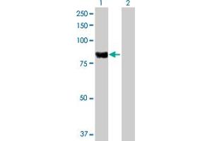 Western Blot analysis of PLA2G6 expression in transfected 293T cell line by PLA2G6 MaxPab polyclonal antibody. (PLA2G6 antibody  (AA 1-752))