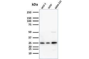 Western Blot Analysis of Human MCF-7,T47D and MDA-231 cell lysate using Monospecific Mouse Monoclonal Antibody (SPM518) to Mammaglobin.