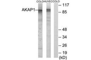 Western Blotting (WB) image for anti-A Kinase (PRKA) Anchor Protein 1 (AKAP1) (AA 281-330) antibody (ABIN2889701) (AKAP1 antibody  (AA 281-330))
