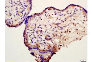 Formalin-fixed and paraffin embedded human placenta labeled with Anti-HSD11B2 Polyclonal Antibody, Unconjugated (ABIN701680) at 1:200 followed by conjugation to the secondary antibody and DAB staining (HSD11B2 antibody  (AA 151-250))