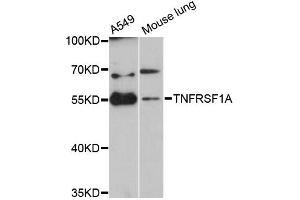 Western blot analysis of extracts of various cell lines, using TNFRSF1A antibody (ABIN5970729) at 1:3000 dilution.