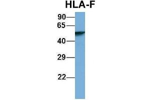 Host:  Rabbit  Target Name:  HLA-F  Sample Type:  Human Fetal Lung  Antibody Dilution:  1. (HLA-F antibody  (N-Term))