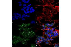 Immunocytochemistry/Immunofluorescence analysis using Rabbit Anti-RAB1B Polyclonal Antibody (ABIN5066509).