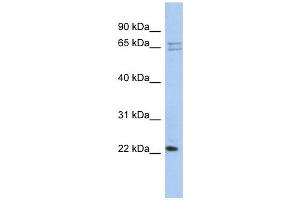 RPL18 antibody used at 1 ug/ml to detect target protein. (RPL18 antibody  (N-Term))
